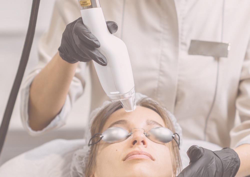 Procedimento com laser fracionado