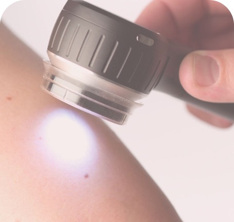 Exame de lesão de pele com dermatoscópio