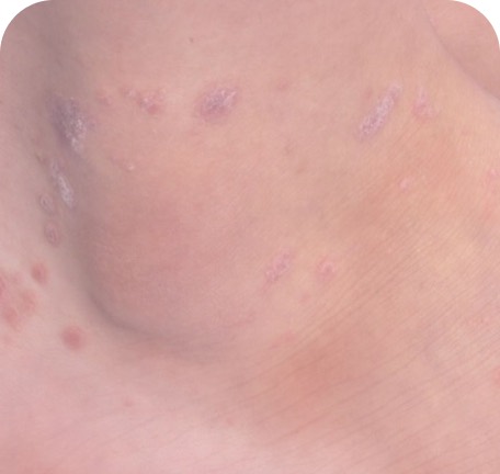 Exame dermatológico detalhado da pele